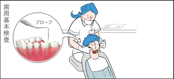 歯周病基本検査
